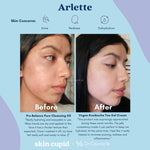 DR CEURACLE x SKIN CUPID 5-Step Glow Routine Arlette