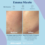 DR CEURACLE x SKIN CUPID 5-Step Glow Routine Emma Nicole