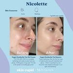 DR CEURACLE x SKIN CUPID 5-Step Glow Routine Nicolette