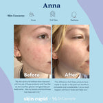 DR CEURACLE x SKIN CUPID 5-Step Glow Routine Anna