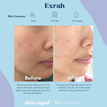 DR CEURACLE x SKIN CUPID 5-Step Glow Routine Exrah